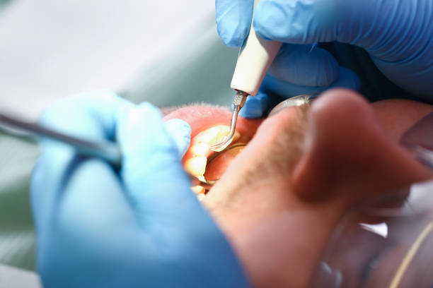 Best Emergency Cosmetic Dentistry (e.g., broken veneers) in Lebanon, IN