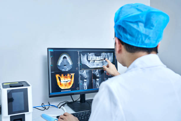 Best Broken or Chipped Tooth Repair in Lebanon, IN